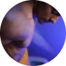 Localised Cryotherapy